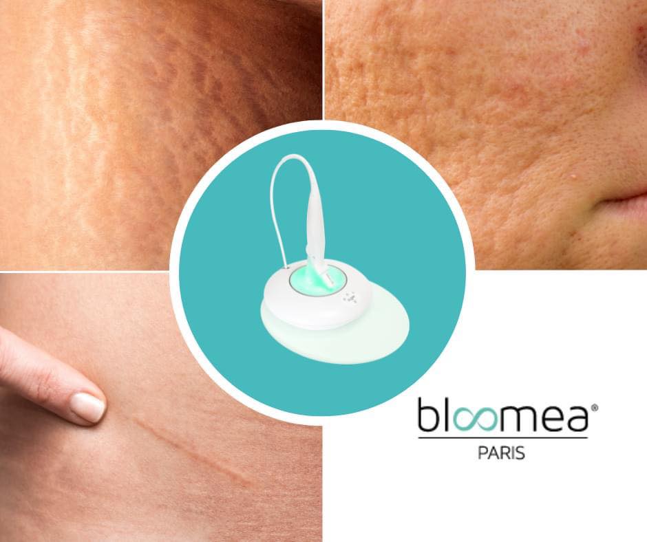 bloomea picture